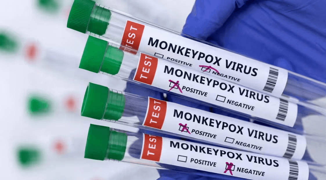 UAE health experts urge caution after first case of monkeypox detected