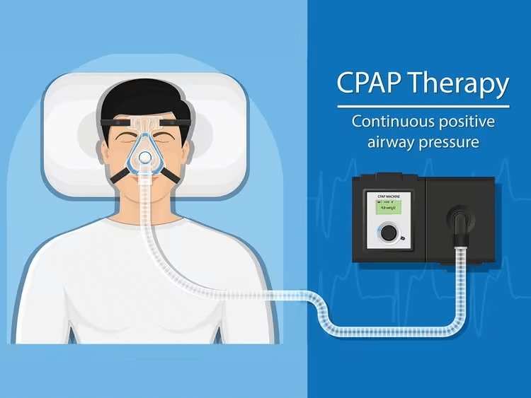 Struggling to breathe while sleeping? How one Indian expat in Dubai beat sleep apnea