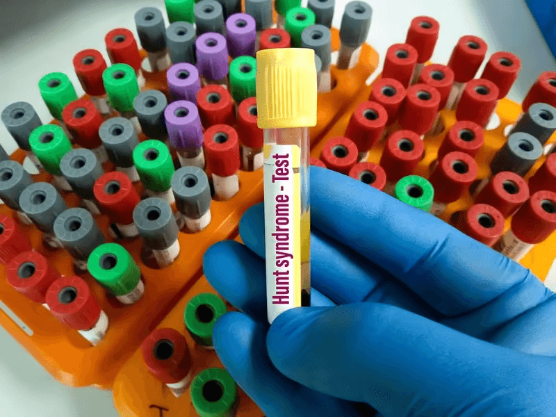 Justin Bieber’s facial paralysis shifts focus on rare condition known as Ramsay Hunt syndrome